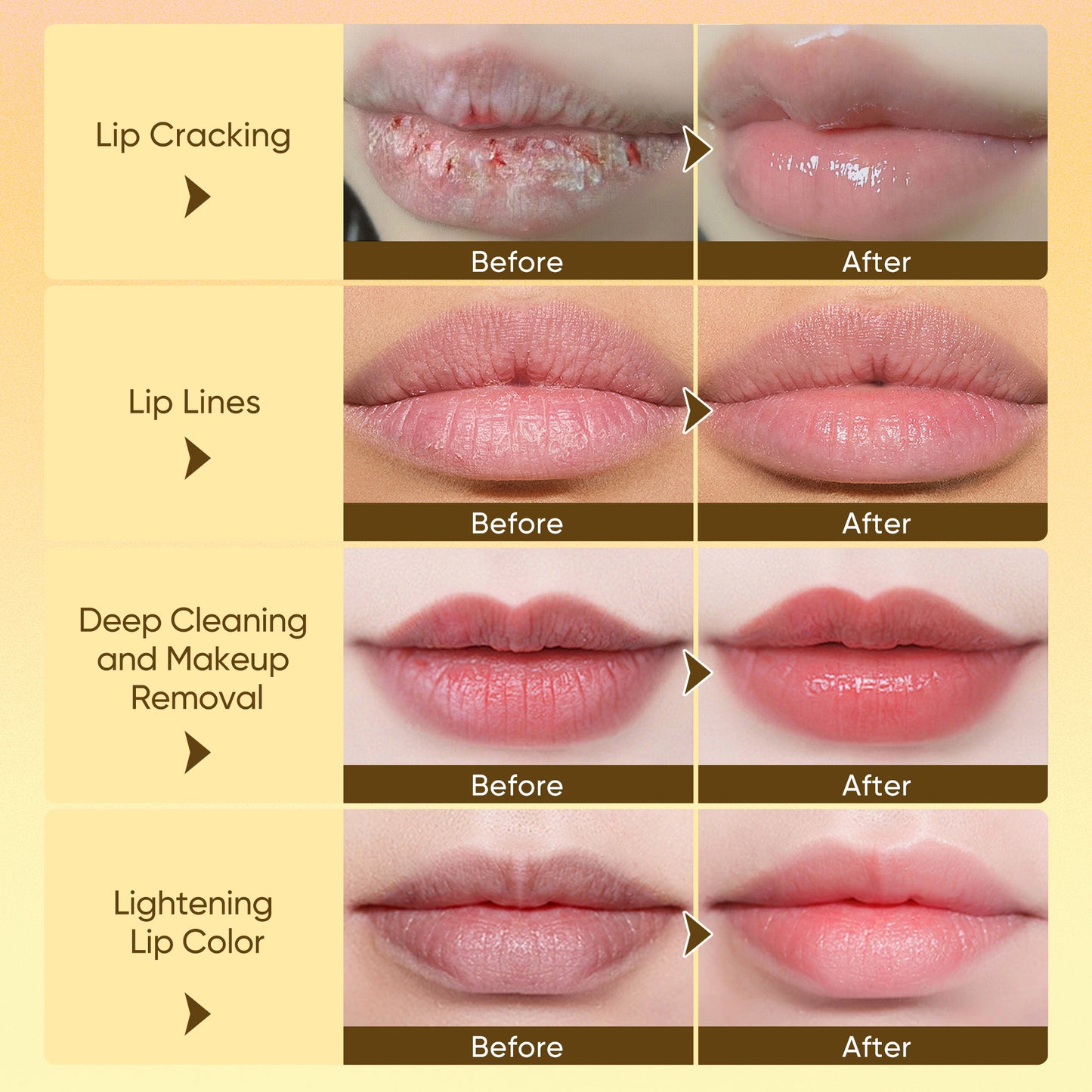 Misoour VC Lip Care Kit: Bubble Lip Mask + 2 Lip Serums with 5 VC extracts, Deep Cleansing Moisturizing, Skincare Essential for Lipcare Hydrating