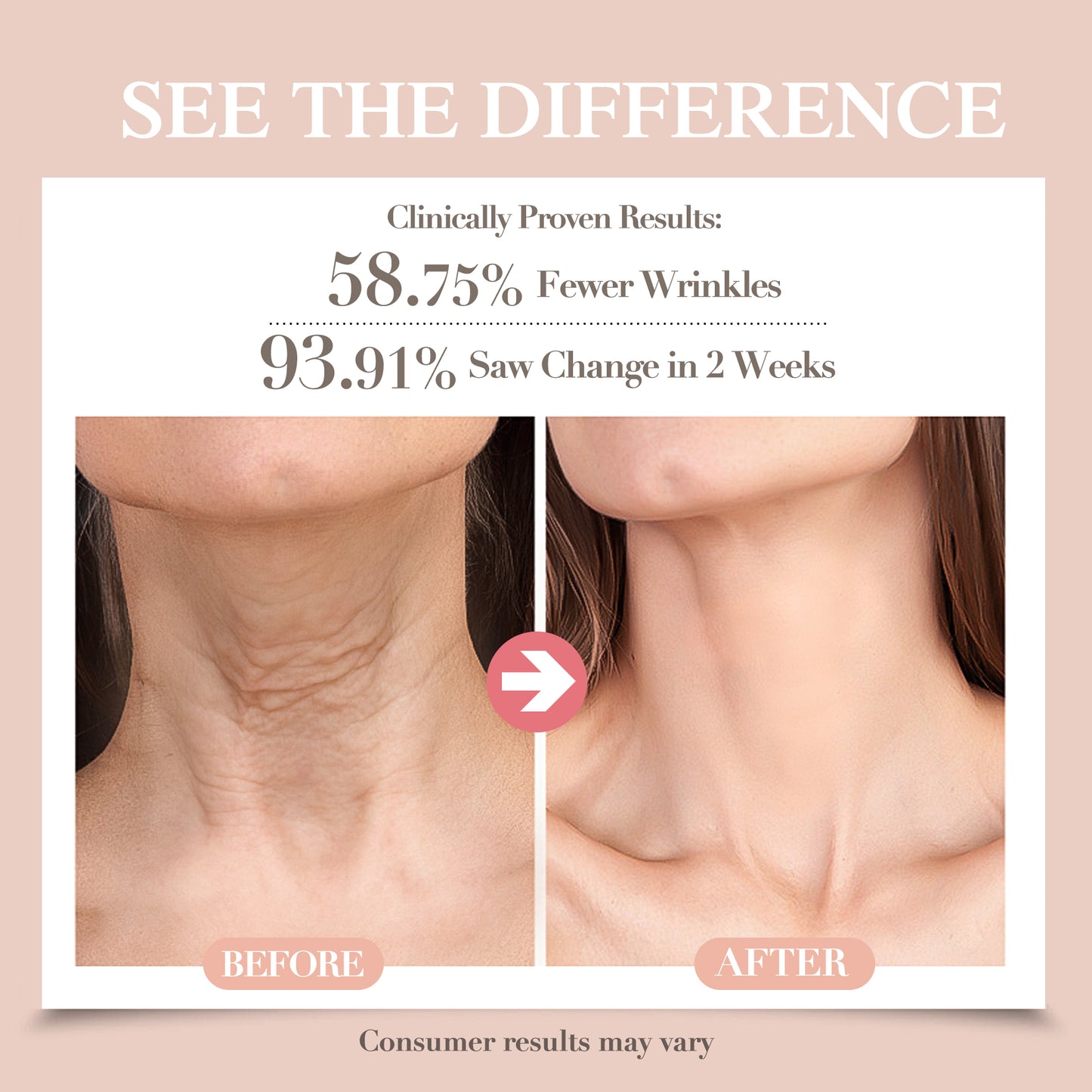 Misoour Neck Mask Set:Collagen Peptide Anti-Wrinkle Neck Mask + Astaxanthin Firming & Smoothing Serum|Reduce neck wrinkles, Moisturize and brighten,Firm and lift