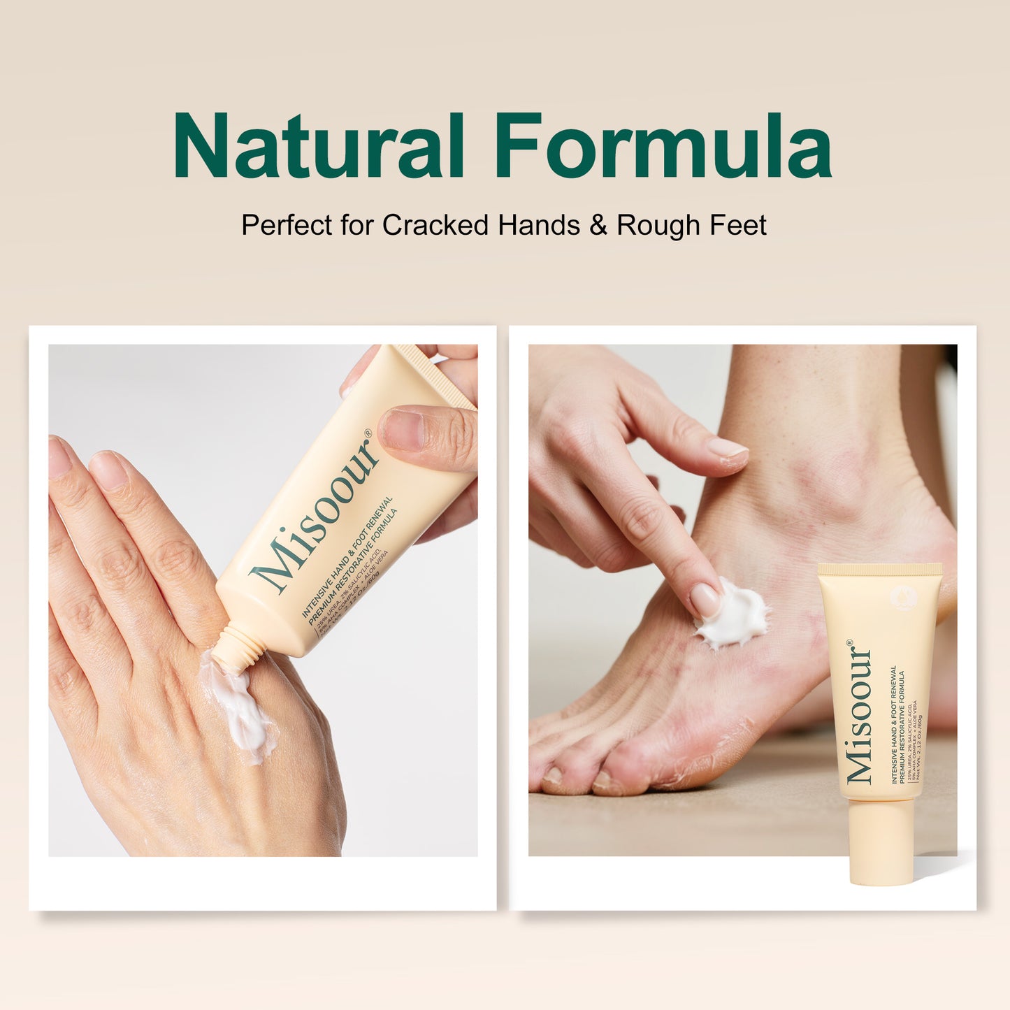 Misoour Intensive Hand & Foot Renewal Cream, Contains Urea, Salicylic Acid, AHA, Aloe Vera, Remove Dead Skin and Moisturize Dry Rough Skin, For All Skin Types