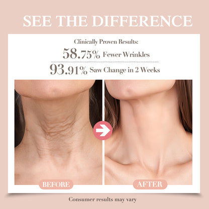 Misoour Neck Mask Set:Collagen Peptide Anti-Wrinkle Neck Mask + Astaxanthin Firming & Smoothing Serum|Reduce neck wrinkles, Moisturize and brighten,Firm and lift
