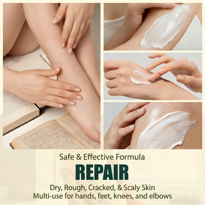 Misoour Intensive Hand & Foot Renewal Cream, Contains Urea, Salicylic Acid, AHA, Aloe Vera, Remove Dead Skin and Moisturize Dry Rough Skin, For All Skin Types