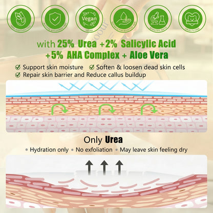 Misoour Intensive Hand & Foot Renewal Cream, Contains Urea, Salicylic Acid, AHA, Aloe Vera, Remove Dead Skin and Moisturize Dry Rough Skin, For All Skin Types