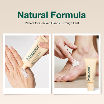 Misoour Intensive Hand & Foot Renewal Cream, Contains Urea, Salicylic Acid, AHA, Aloe Vera, Remove Dead Skin and Moisturize Dry Rough Skin, For All Skin Types